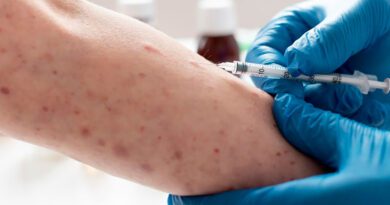 Mpox: exame disponível em 14 estados detecta nova variante após caso confirmado no Sul