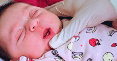 Maternidade realiza Teste da Linguinha para detecção em até 24 horas de anquiloglossia Maternidade realiza Teste da Linguinha para detecção em até 24 horas de anquiloglossia