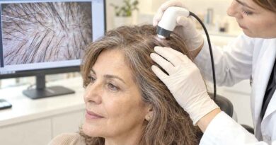 Menopausapor que meu cabelojá não é o mesmo? Menopausapor que meu cabelojá não é o mesmo?